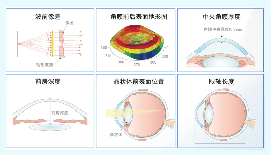 郑州全飞秒or全光塑怎么选?尖峰眼科全面解析